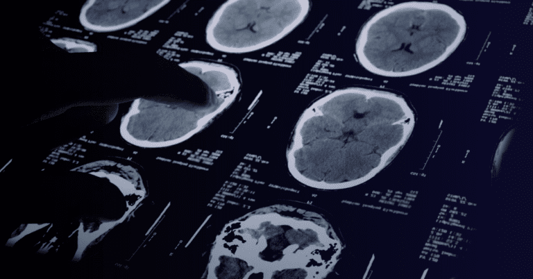 ¿Quién trata la neuralgia?