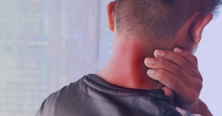 Dolor de cuello muscular