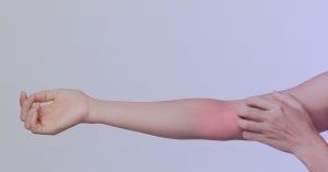 dolor de antebrazo